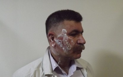 Bomba atmak serbest, protesto etmek yasak!